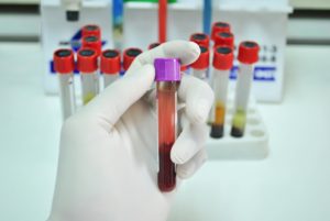 Burlington Twp NJ DWI Charge Defense